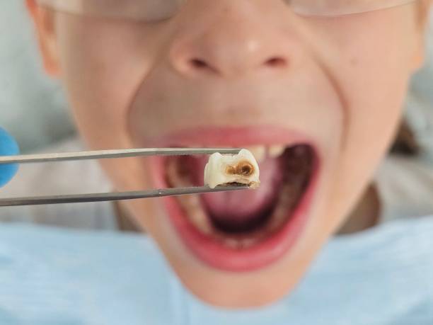 Best Emergency Denture Repair in Stryker, OH