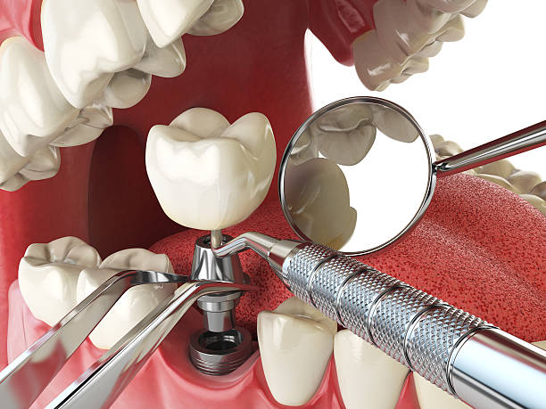 Best Emergency Treatment for Jaw Pain or Injury in Stryker, OH